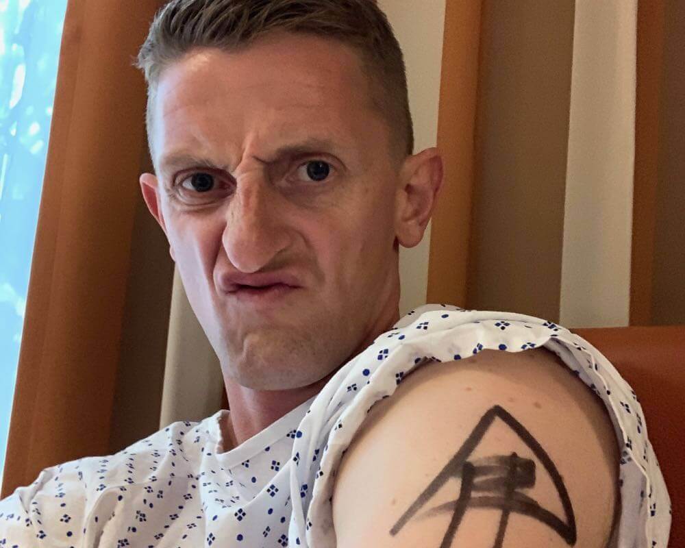 Blog: Shoulder 2. Ollie Moto in his gown before his shoulder surgery.